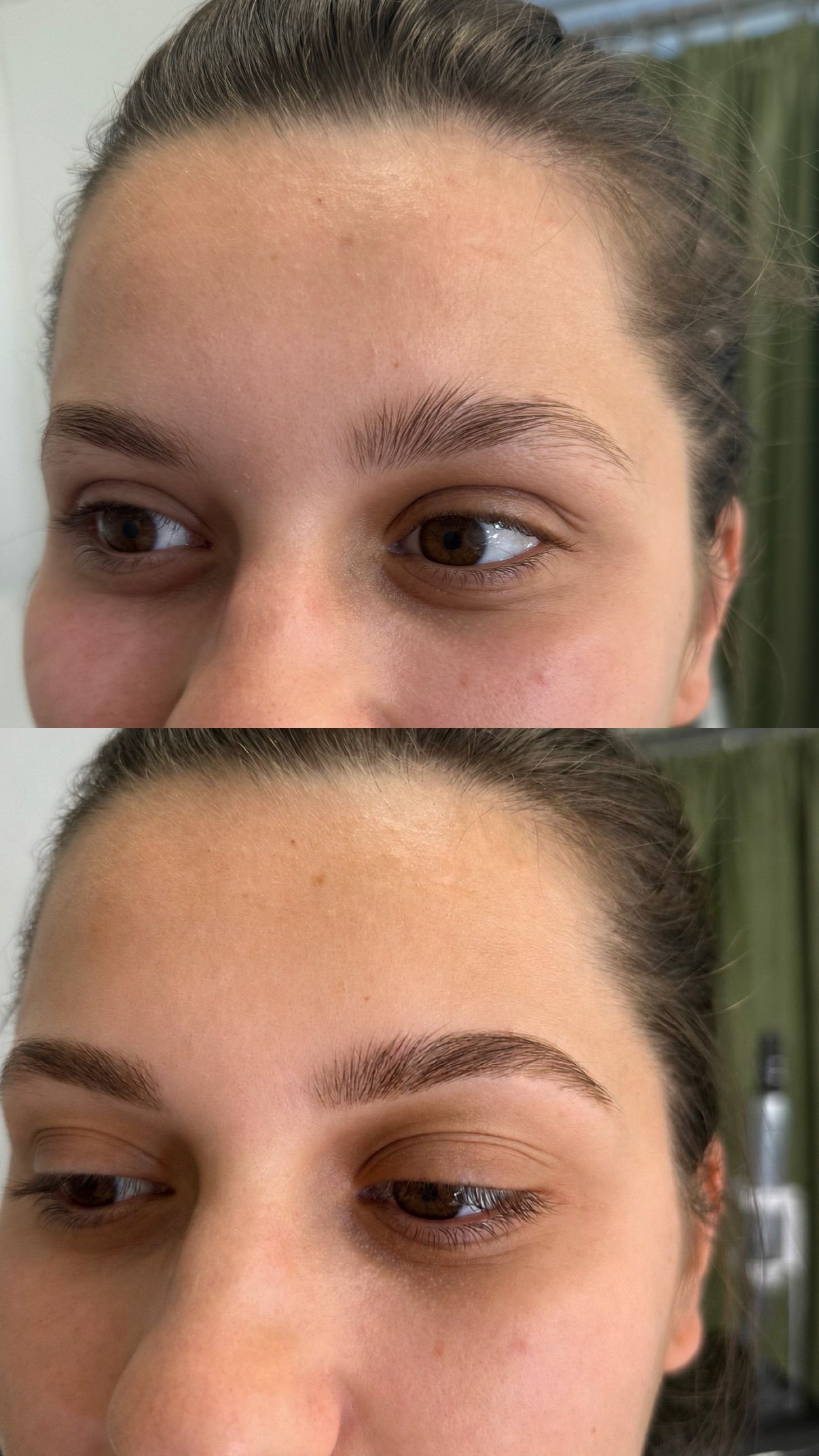 Patricia Mocuța - Tratamentele tenului și stilizarea sprâncenelor - Before & After Timișoara (6)
