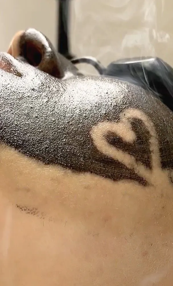 Hollywood Carbon Peeling, tratament facial profesional Timișoara